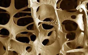 Dünya Osteoporoz Günü